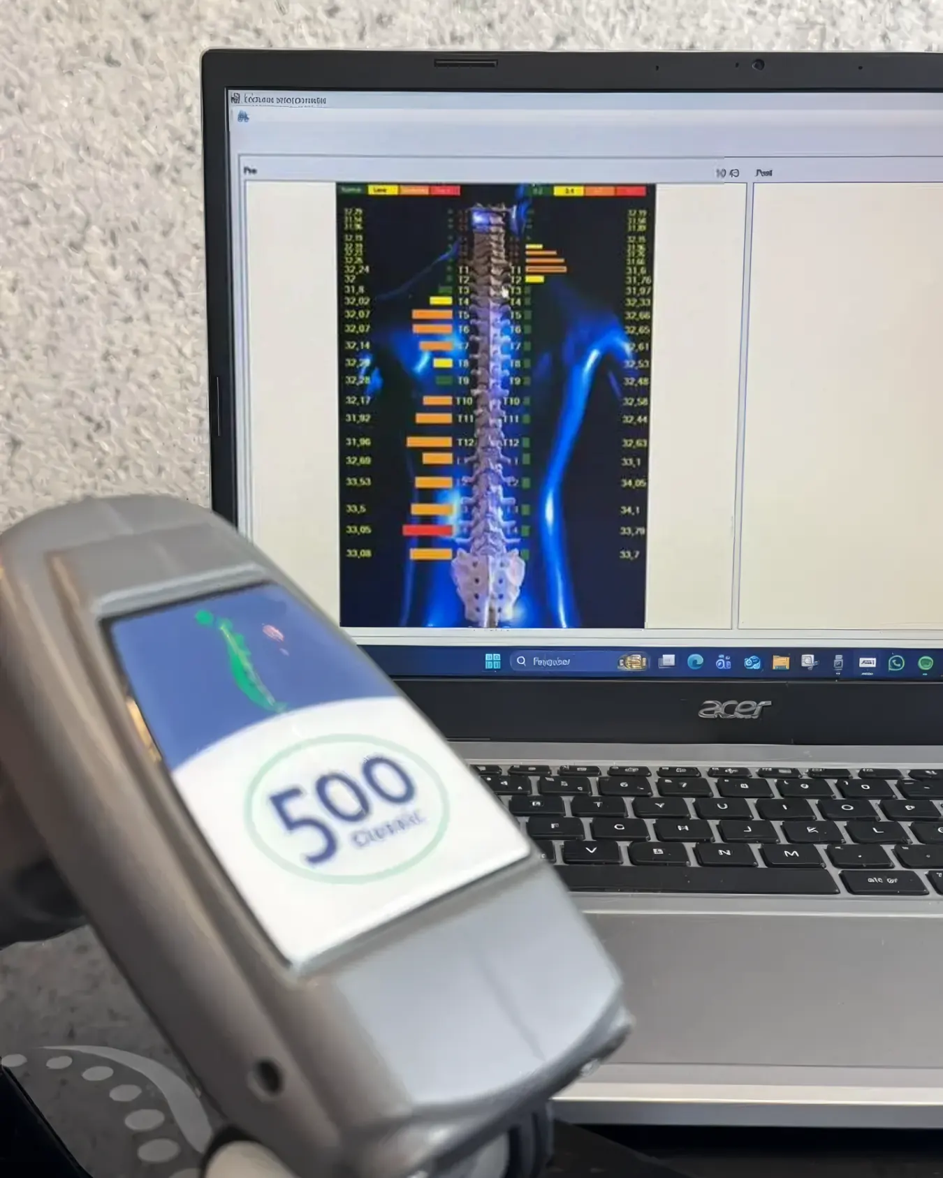 Scanner ThermoScan de termografia da coluna vertebral na Clínica Coluna mais Leve
