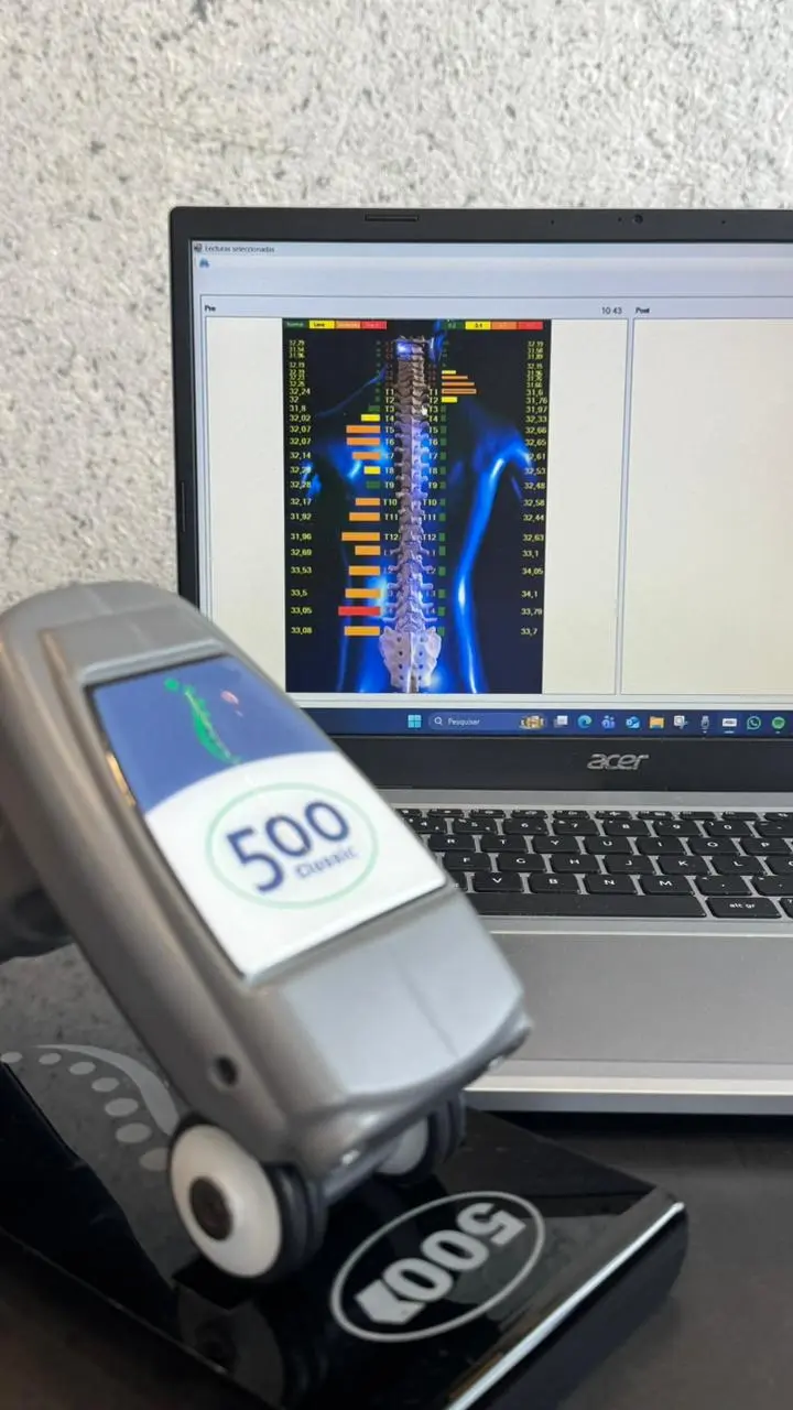 ThermoScan 500 Classic - Scanner da Coluna Vertebral exclusivo na Clínica Coluna mais Leve em Gravataí